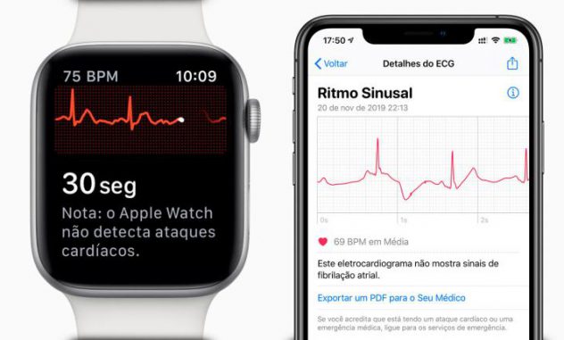 MONITORAMENTO DA FIBRILAÇÃO ARTERIAL POR MEIO DO APPLE WATCH